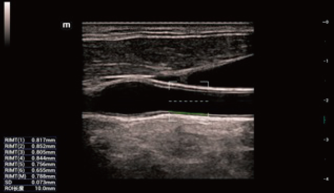 LETOU国际米兰·(中国区)官方网站