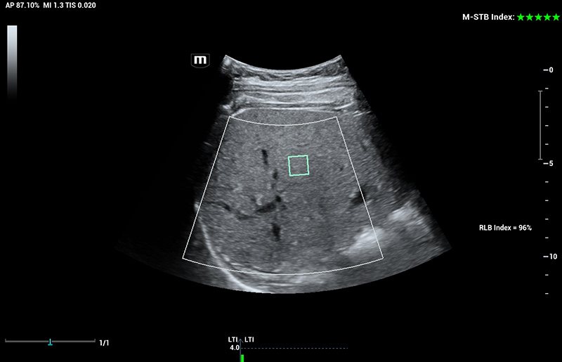 LETOU国际米兰·(中国区)官方网站