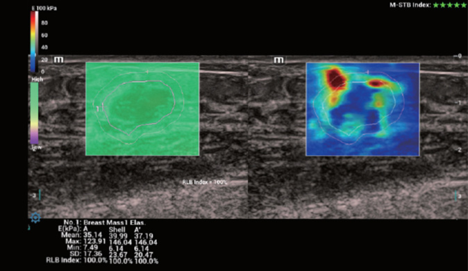 LETOU国际米兰·(中国区)官方网站