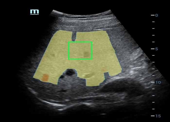 LETOU国际米兰·(中国区)官方网站
