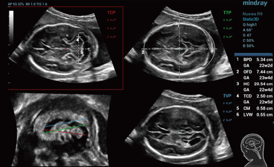 LETOU国际米兰·(中国区)官方网站