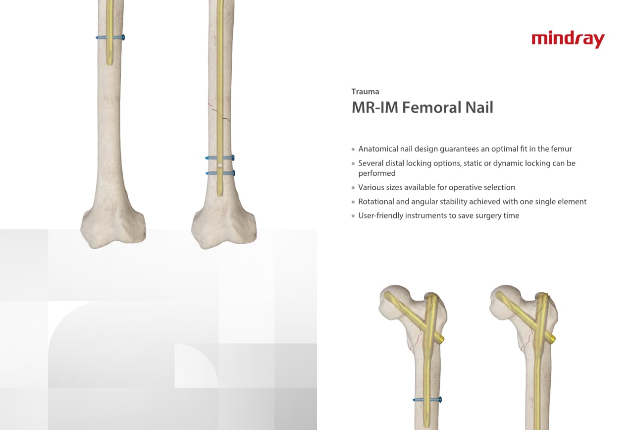 LETOU国际米兰·(中国区)官方网站