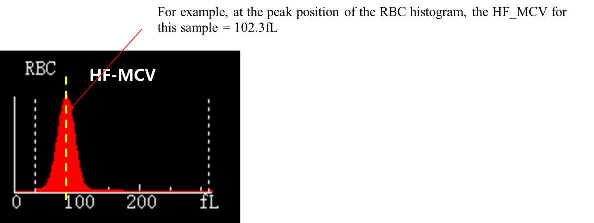 HF-MCV vs RBC histogram