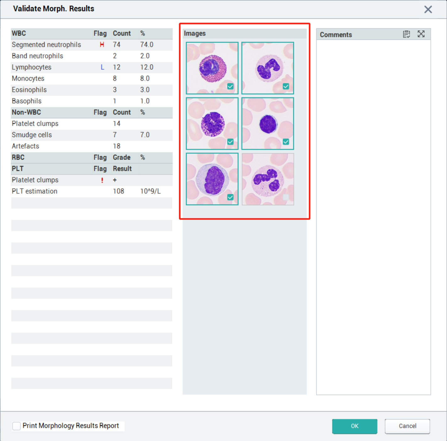 WBC Validate Morph. Results
