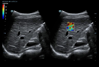 LETOU国际米兰·(中国区)官方网站