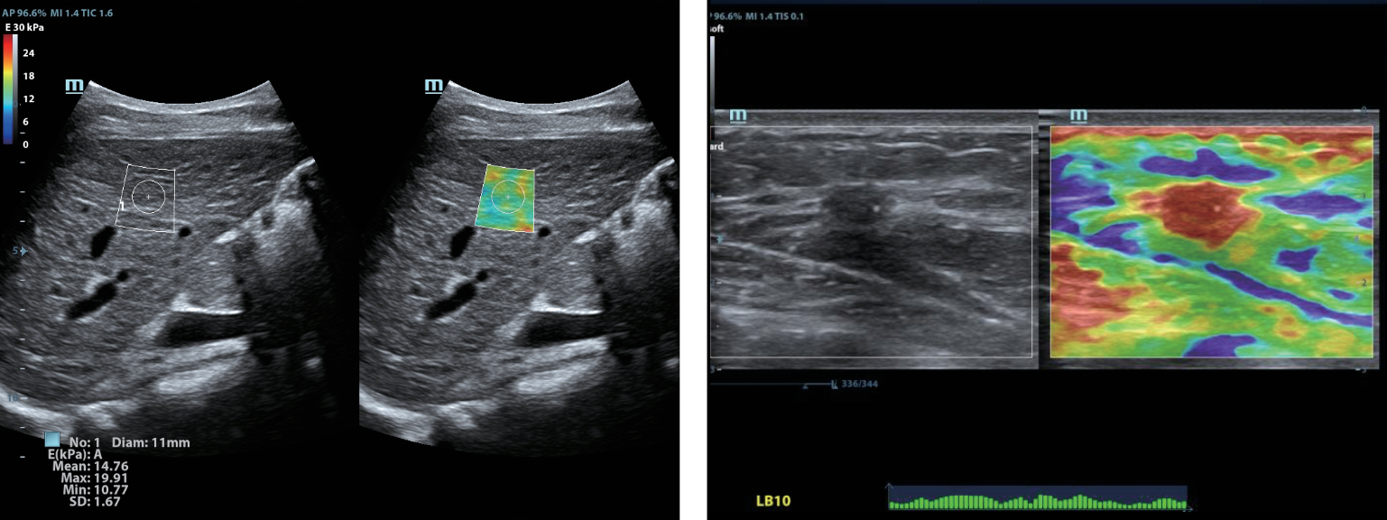 dc-80-exp-ru-fig3-1-pc