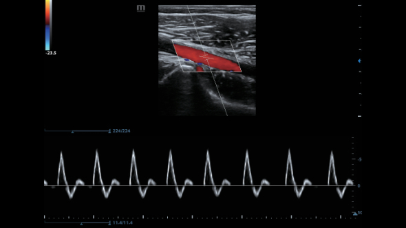 dc-80-exp-ru-fig4-3-pc