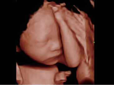 dc-80-exp-ru-fig7-11