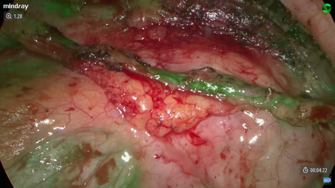 LETOU国际米兰·(中国区)官方网站