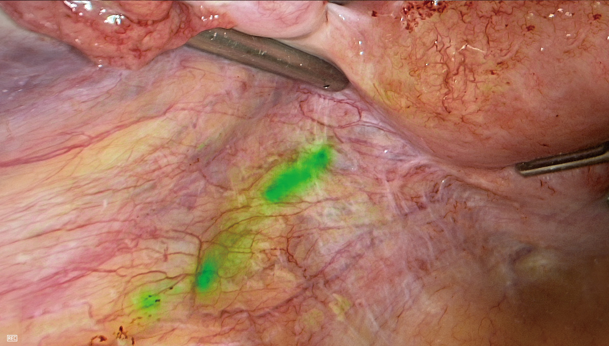 LETOU国际米兰·(中国区)官方网站