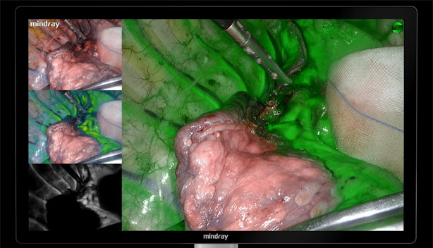 LETOU国际米兰·(中国区)官方网站