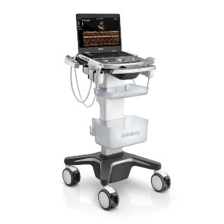MX8 Portable Ultrasound System: