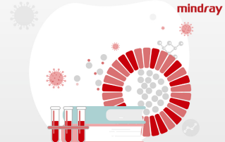 W jaki sposób ferrytyna jest powi?zana z chorob? COVID-19?
