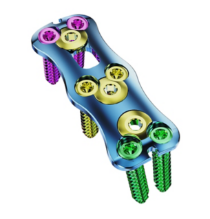 Система передних шейных пластин MS