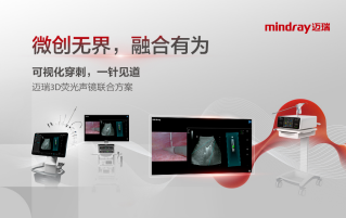 “手术路径导航”辅助操作统一价钱立项，，，，，，letou国际米兰官网融合立异助“精准医疗”转型提速